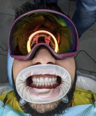 Dental service