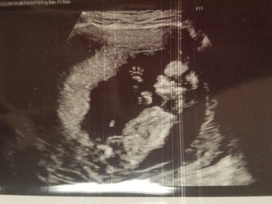 our healthy baby at 12 weeks 4 days!