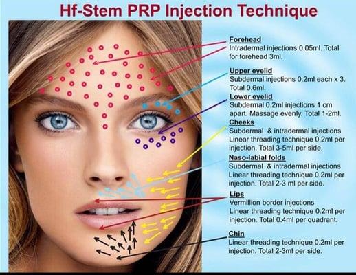 PRP and its benefits