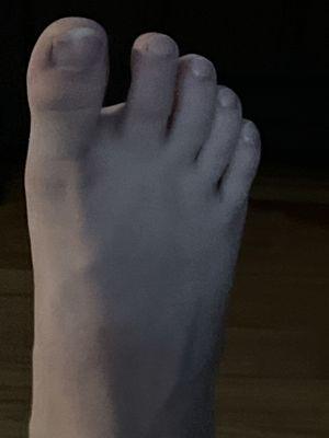 Feet