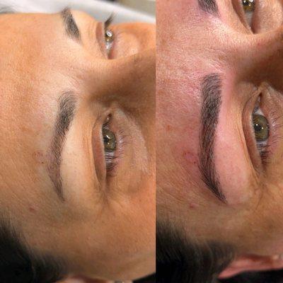 Before and after 3D Microblading