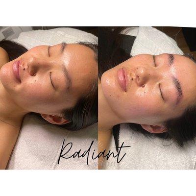 Deluxe Derm Facial & Brow lamination for fluffy brows and glowing skin