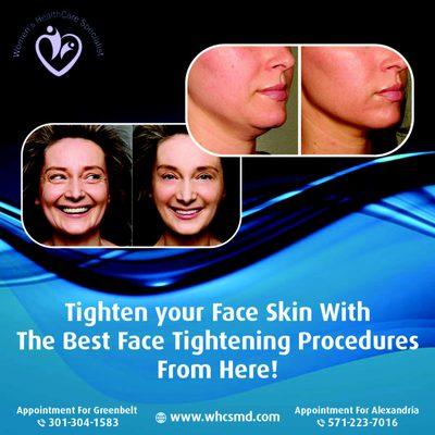 Face Tightening Procedures