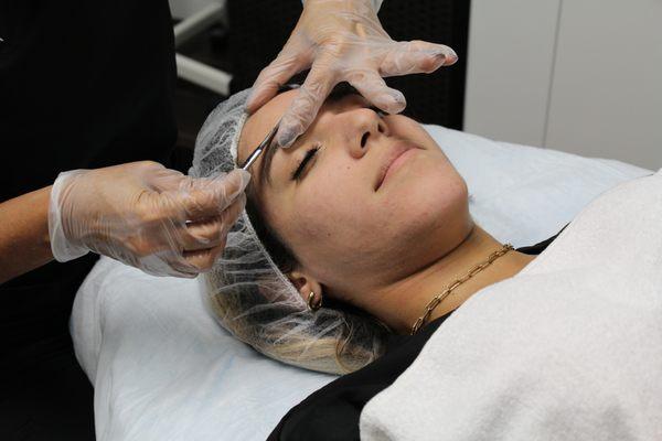 Dermaplaning is a physical exfoliation method that requires the use of a sterile surgical scalpel to gently shave the top layer of the skin.