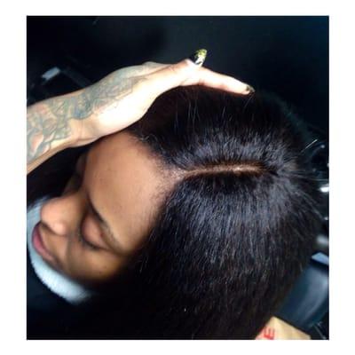 Lace closure Application