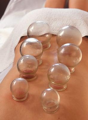 Cupping is used to relieve back pain and tension- similar to a deep tissue massage.