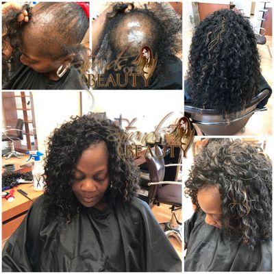 Tree Braids by Ethena- NO heat, NO glue, NO crochet
Alopecia client