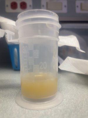 The breast milk I produced on the 4th day after my NICU baby's birth. The cookies worked!!!