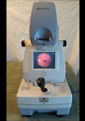 Retinal Camera with an image of my son's retina