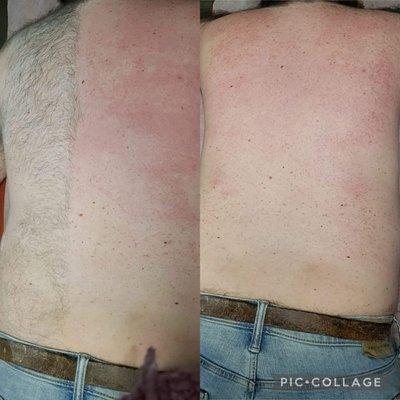 Full men's back wax