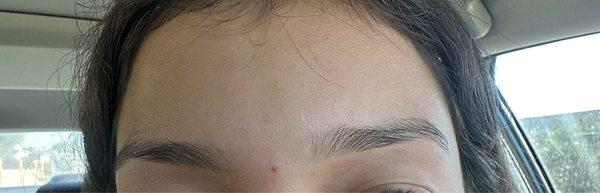 Uneven eyebrows