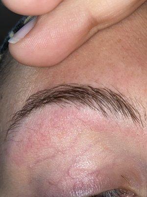 Eyebrow with multiple spots not removed