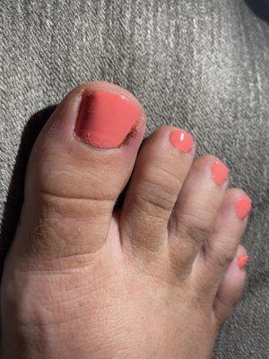 Infected toe