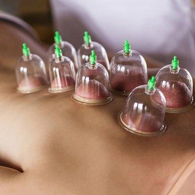 CUPPING MASSAGE  $60/Hour