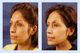 Florida Ear Nose Throat & Facial Plastic Surgery