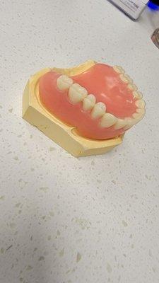 Economy Tier Uper Denture