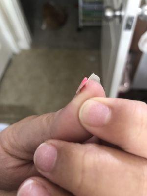 Part of my nail she ripped off.