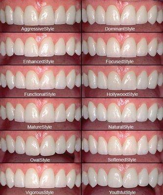 Smile Design Pattern