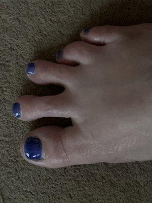 Gel Pedicure 1day after