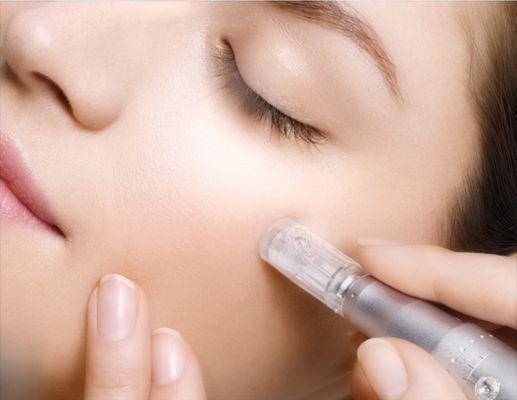 Microneedling!