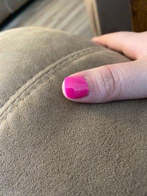 This thumbnail is cut clear down past my skin, whereas the rest of the nails are longer.