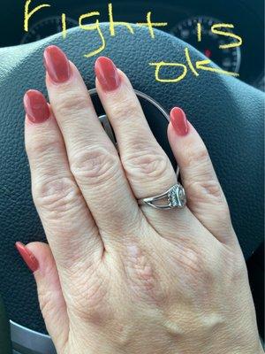 Right hand .. even nails but residue on fingers above nails