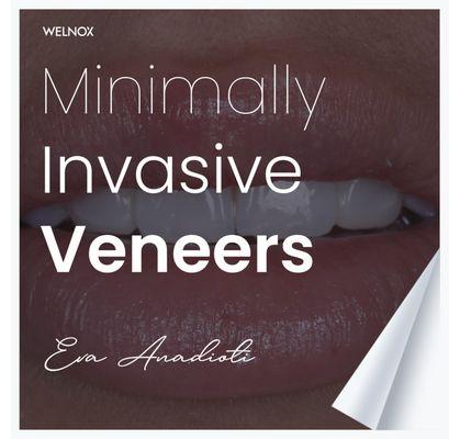 Affordable Veneers