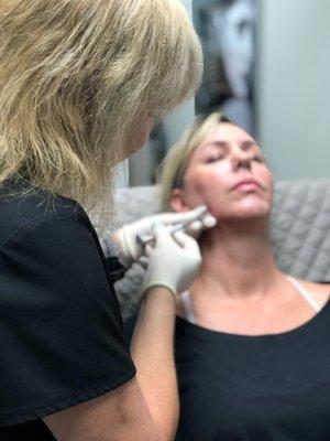 ARNP Donna treating a patient with Juvéderm jaw filler.