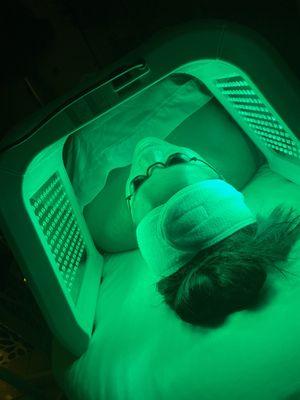 Green LED treatment for helping to treat hyperpigmentation and dark spots