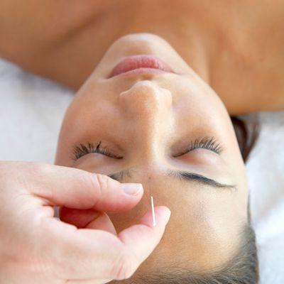 Relax and unwind your mind with acupuncture at Sage.