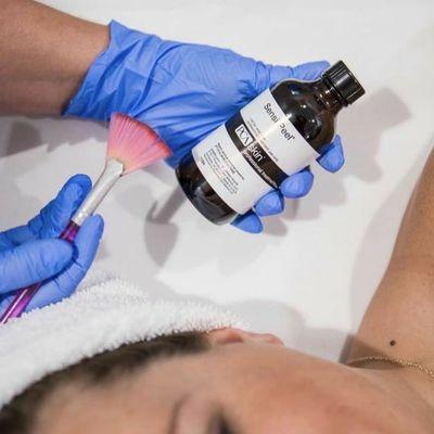 Chemical peel