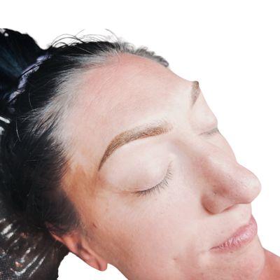 Fusion Brow Correction