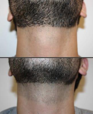 PERFECT NECK LINE AD NO MORE IRRETATION