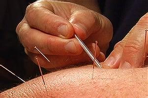 1000 Folded Cranes Acupuncture