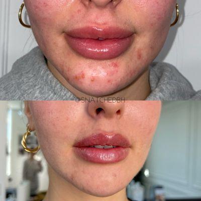 SKIN & LIP TRANSFORMATION