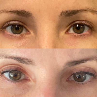 Eyeliner upper (liner) and lower (lash enhancement) before and after