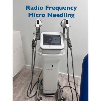 RF Micro-needling. Legend Lumenis