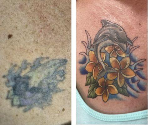 Before and after coverup