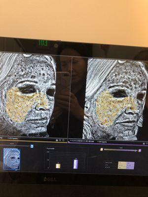 Digital Skin Analysis