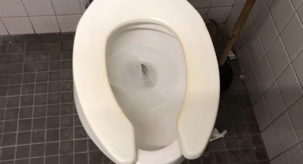 Toilet seat yellow rings