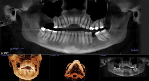 Implants and Periodontal Arts - Endo Arts