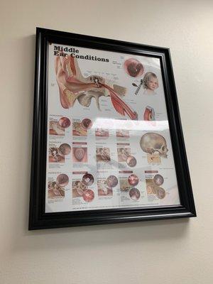 Chart of middle ear conditions.