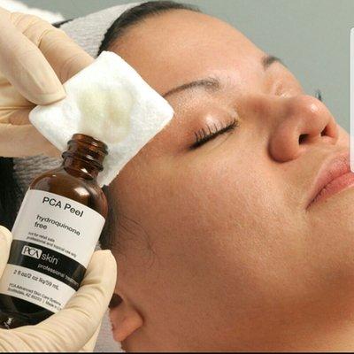 We offer PCA SKIN chemical peels. Great for discoloration, acne and overall health of the skin.