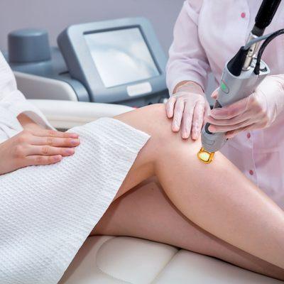 Laser Hair Removal