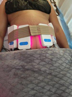 Laser Lipo