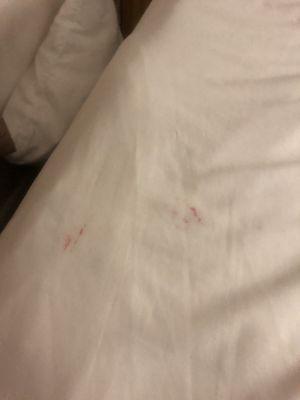 More traces of blood on the sheets