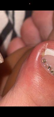 Puss from my toe after going there!