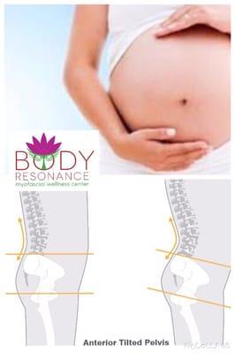 Myofascial release can help ensure a healthy and normal pregnancy, labor & delivery.