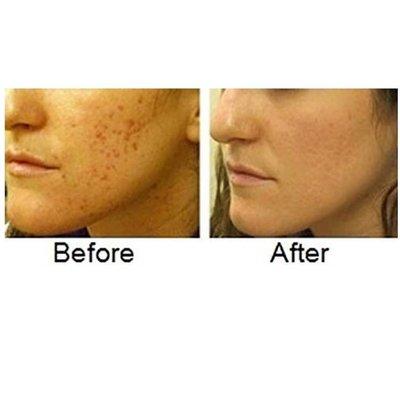 Skin care results from regular facials with Caz! Cazmetics