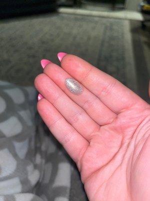 Ring Finger Nail fell off